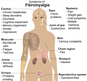 Common symptoms of Fibromyalgia in the female body.